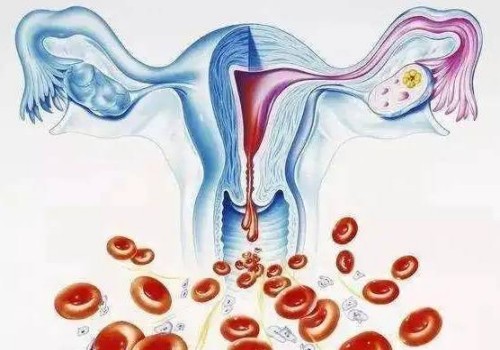 孕期牙齒問(wèn)題不容忽視，情形嚴(yán)重可導(dǎo)致胎兒早產(chǎn)