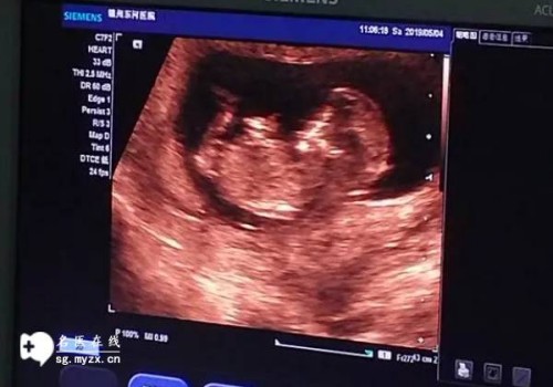 2023年徐州第一人民醫(yī)院試管嬰兒攻略，內(nèi)附成功率與費(fèi)用構(gòu)成！_1