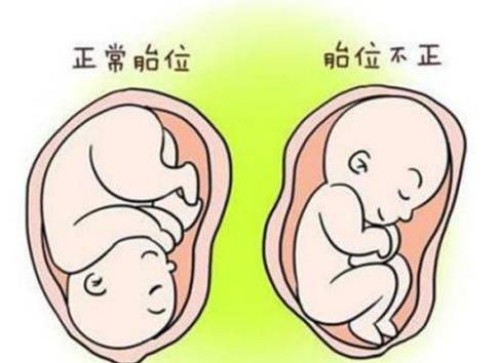 寧波助孕：三代篩查不合格仍然想要移植？能夠接受這些風險就可以繼續(xù)