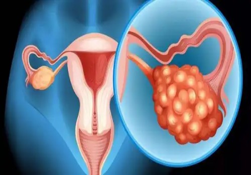 寧波試管助孕價(jià)格：怎樣通過(guò)孕檢單判斷胎兒性別？教你正確看懂孕檢單