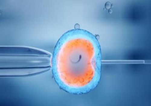 羊水穿刺染色體報(bào)告解讀：是男孩還是女孩一目了然！